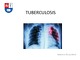 Tuberculosis presentation