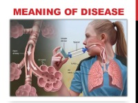 Chronic disease: asthma 2