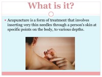 Slides on Acupuncture 2