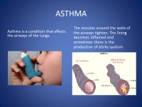 Asthma And DM slides 1