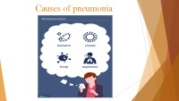 Pneumonia presentation 5
