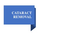 Cataract removal 1